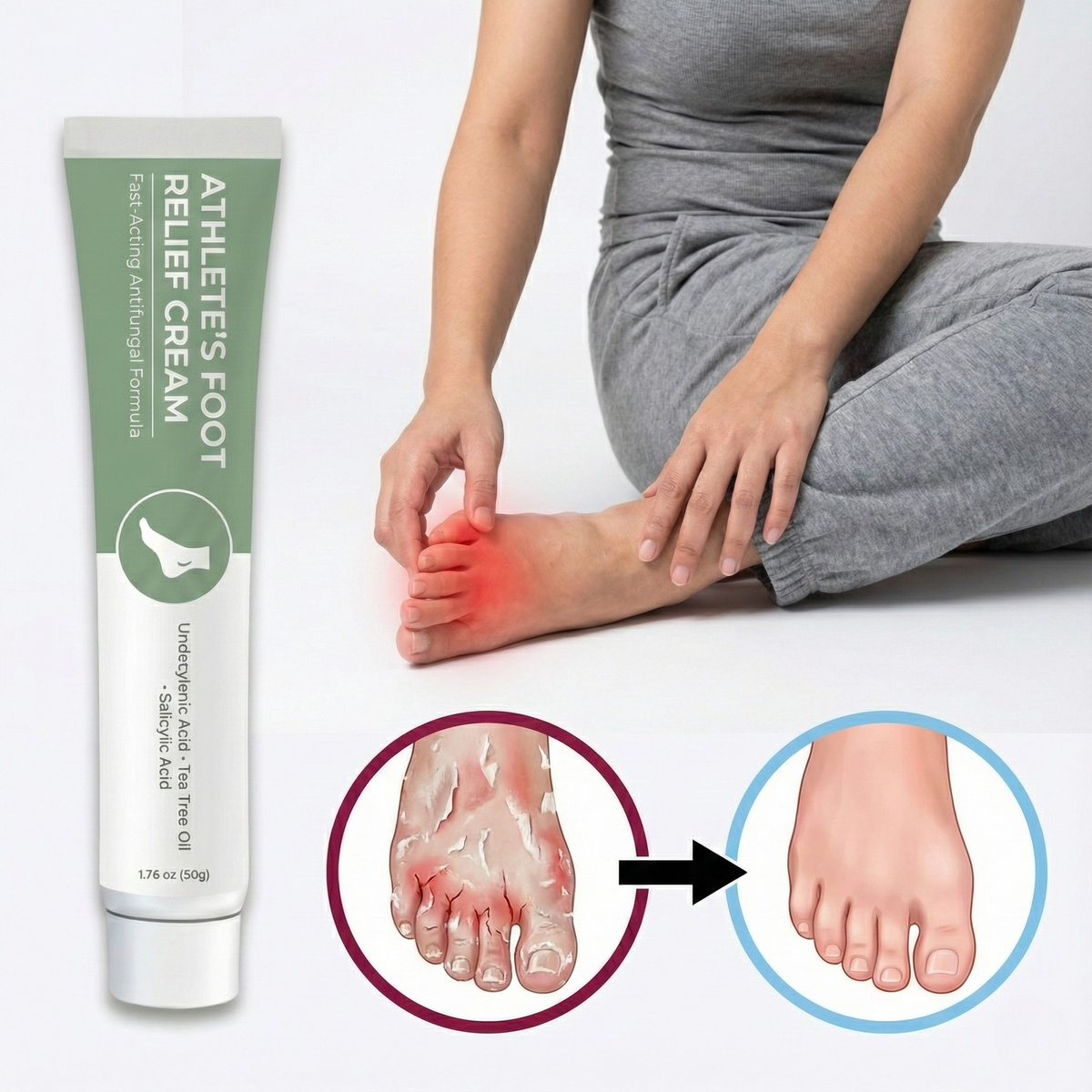 3x Athlete's Foot Relief Cream